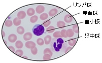 白血球分類